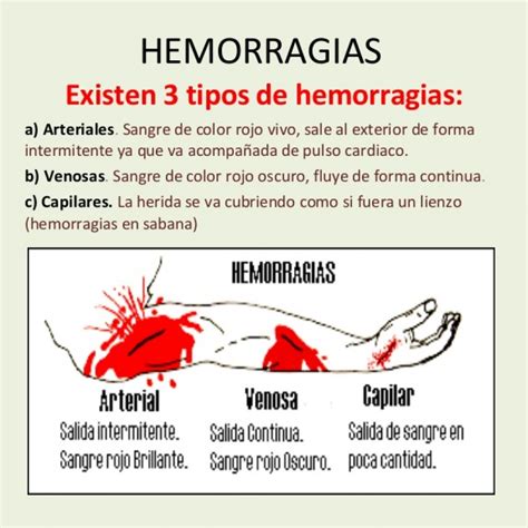 Blog Hemorragias Y Heridas Imagenes