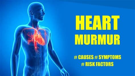 Heart Murmurs Common Heart Murmurs Symptoms And Causes For Systolic