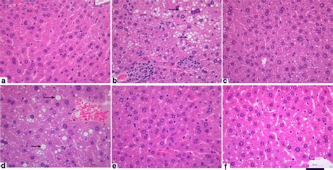 Hematoxylin And Eosin He Stained Images Of Liver Histopathology From