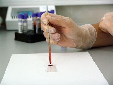 A Blood Test That Can Detect Cancer Years Before Symptoms Surface