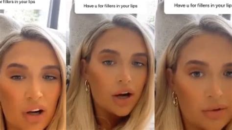 Molly Mae Hague Teases New Lips As She Confesses To Getting Fillers Completely Dissolved Ok