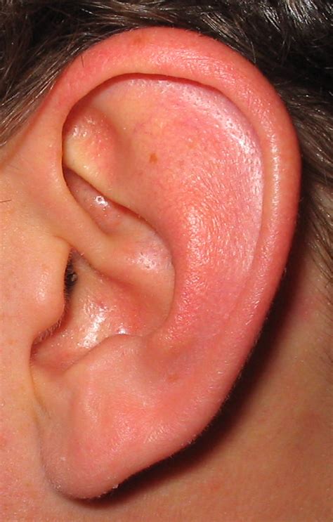 Ear Drainage Smelly Like Fish Best Drain Photos Primagemorg
