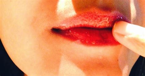 We did not find results for: 11 Cara Alami Memerahkan Bibir yang Hitam | Dokter Gigi