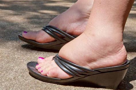 7 Reasons Why You Have Swollen Feet And Ankles Htv