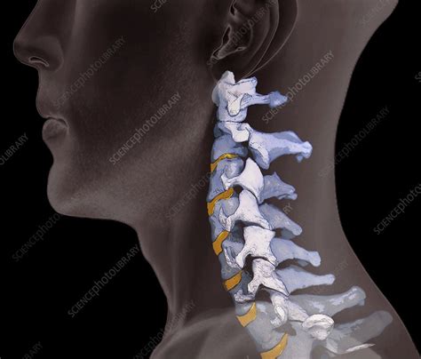 Normal Neck Bones 3d Ct Scan Stock Image F0069114 Science Photo