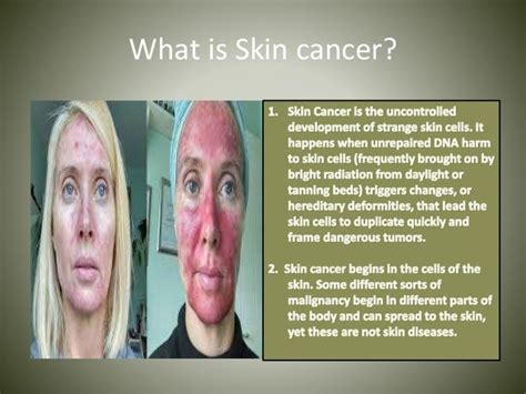 Chemo Skin Care