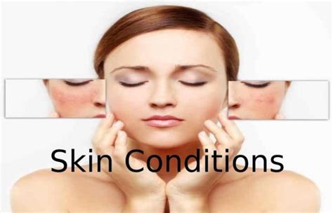 Everything You Need To Know About Common Skin Conditions