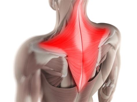 The Incredibly Common Upper Trapezius Knot Neck Pain Solutions