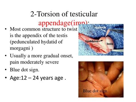 Ppt Scrotal Swelling Powerpoint Presentation Id6841092