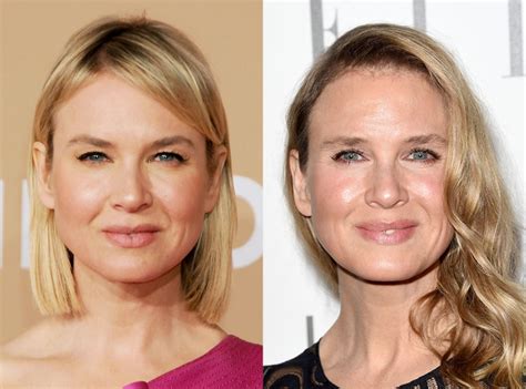 renée zellweger explains why her face looks different