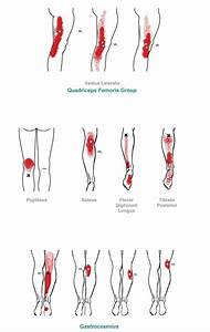 Trigger Point Referral Pattern For The Knee Lower Leg Trigger