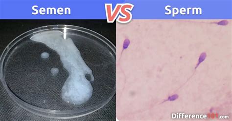 Semen Vs Sperm Key Differences And Faq Difference