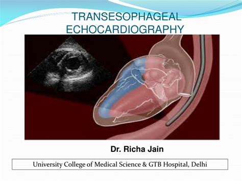 Ppt Transesophageal Echocardiography Powerpoint Presentation Free