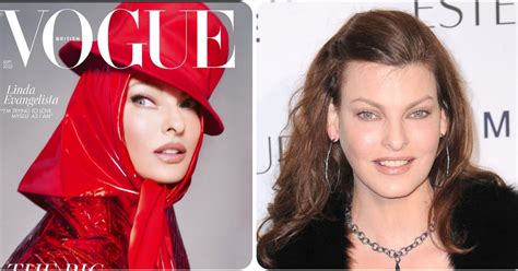 Linda Evangelista Sfigurata Torna Su Vogue Con Le Bende Elastiche