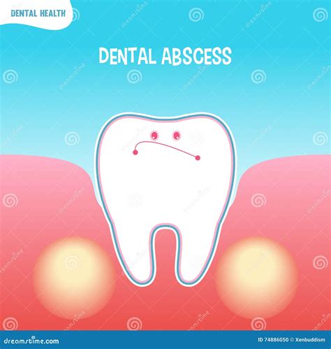 Cartoon Bad Tooth Icon With Dental Abscess Stock Illustration