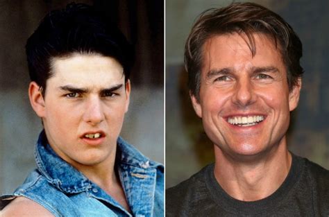 Tom Cruise Schiefe Zähne Tom Cruise GrÃ¶sse ZÃ¤hne Filmpreis Bafta