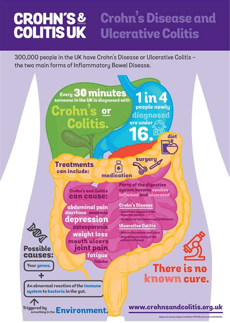 Things You Need To Know About Ulcerative Colitis Crohn S Colitis Uk