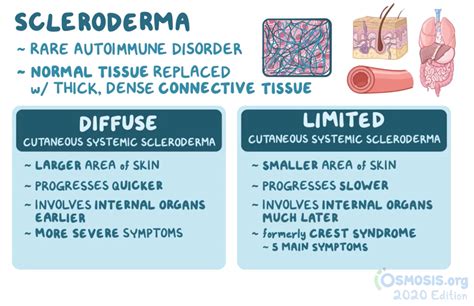 Study Tips Usmle® Step 1 Question Of The Day Scleroderma