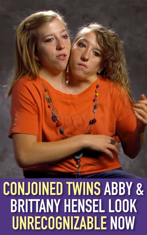 Conjoined Twins Abby And Brittany Hensel Look Unrecognizable Now