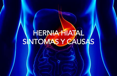 Hernia Hiatal Sintomas Y Causas Enrique Ricardo Jean Silver
