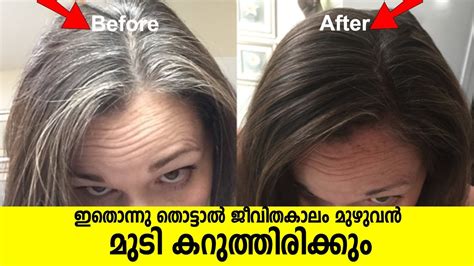 Vitamins For Grey Hair Reversal The Request Could Not Be Satisfied