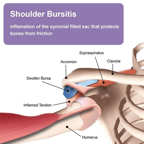 Shoulder Anatomy Bursa Images Human Anatomy Learning Shoulder