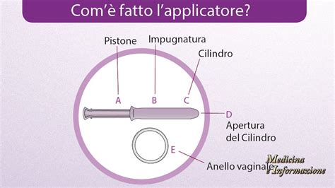 Contraccezione Ormonale Con L Anello Vaginale A Basso Dosaggio YouTube