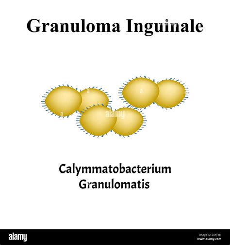 Granuloma Inguinale Hi Res Stock Photography And Images Alamy