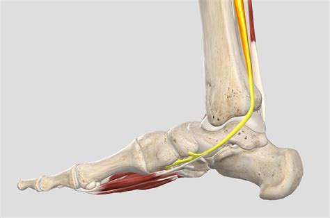 Posterior Tibial Tendon Dysfunction Foot Ankle Specialists In Kelso