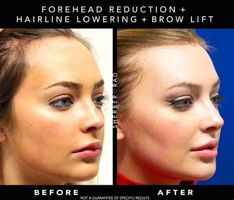 ️how To Make Your Forehead Look Smaller With Hairstyles Free Download