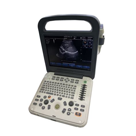 Portable Color Doppler Ultrasound System Echocardiography Machine For