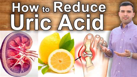 Knowing how to treat gout naturally is much more than just what is on this uric. How to Reduce Uric Acid Naturally?