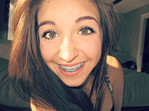 pin by rylee smith on braces ideas braces brace face cute