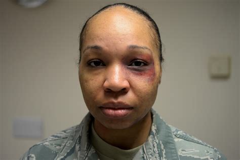 Black Eye Campaign Raises Domestic Violence Awareness Royal Air Force