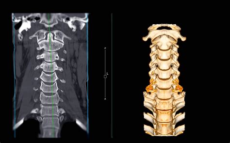 X Rays Ct Scans And Mri Scans Orthoinfo Aaos