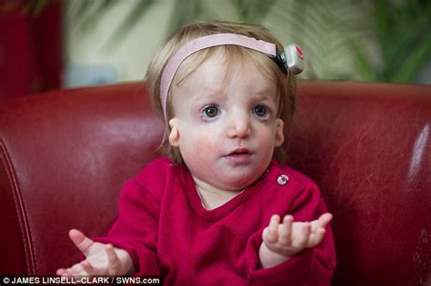 Father With Facial Disfigurement Branded Cruel For Keeping Daughter
