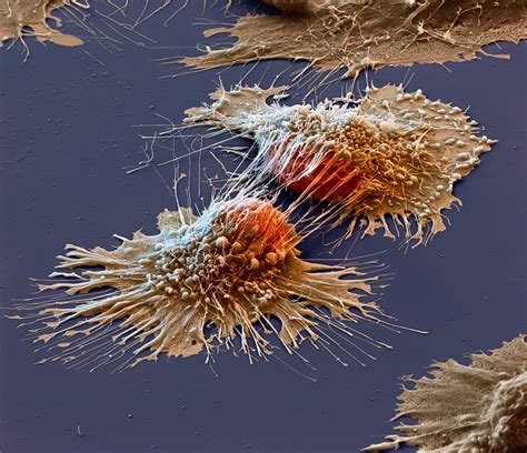 A generalised animal cell as observed under an electron microscope. Cancer cells under an electron microscope : pics