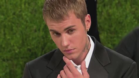 Justin Bieber S Face Partially Paralyzed Ramsay Hunt Syndrome 10tv Com