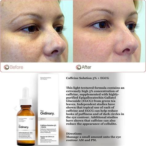 Hyaluronic acid by the ordinary. The Ordinary Peeling Solution Before And After - The ...