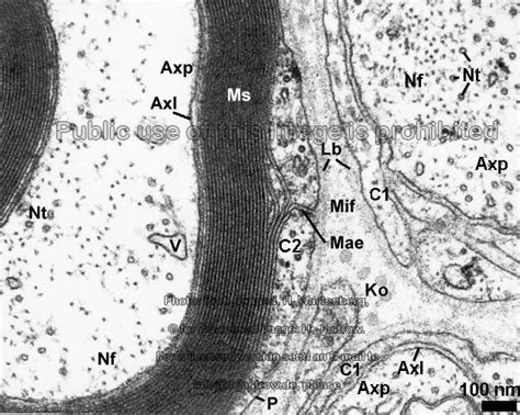 Myelin Sheath Mesaxon Dr Jastrows Electron Microscopic Atlas