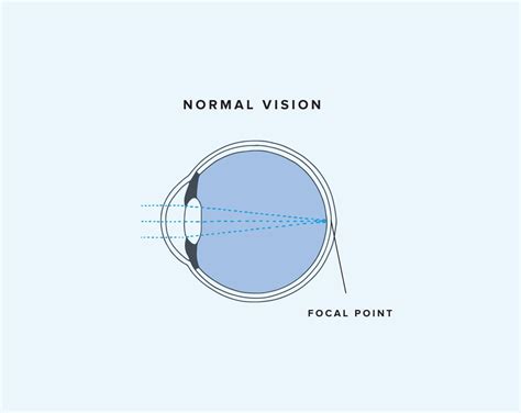 Nearsighted Vs Farsighted Key Differences Warby Parker