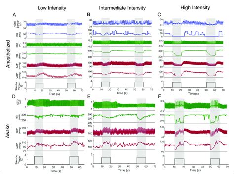 Examples Of Cardiopulmonary Responses To Vns Of Different Intensities