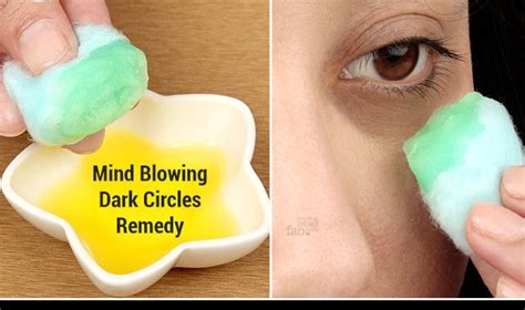Home Remedies For Dark Circles Under The Eyes Top 10 Home Remedies