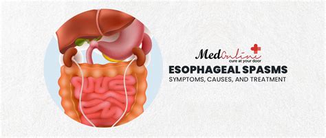 Esophageal Spasms Symptoms Causes And Treatment Medonlinepk