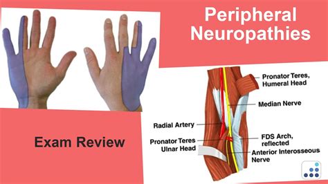 Peripheral Neuropathies Exam Review Christopher S Ahmad Md Youtube