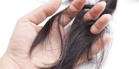 Most commonly, crohn's affects your small intestine and the beginning of your large what are the complications of crohn's disease? PCOS Hair Loss - Cause, Treatment and Home Remedies