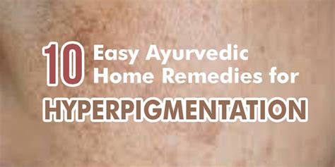 10 Ayurvedic Home Remedies To Eliminate Hyperpigmentation Easily Dr