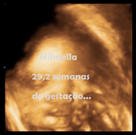 Diário Da Minha Primeira Gestação Ultrassom 3d♥