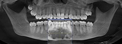 Com June 2013 Diagnosis Uw School Of Dentistry