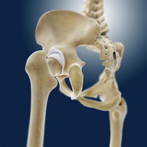Hip Anatomy Photograph By Springer Medizin Science Photo Library Fine Art America